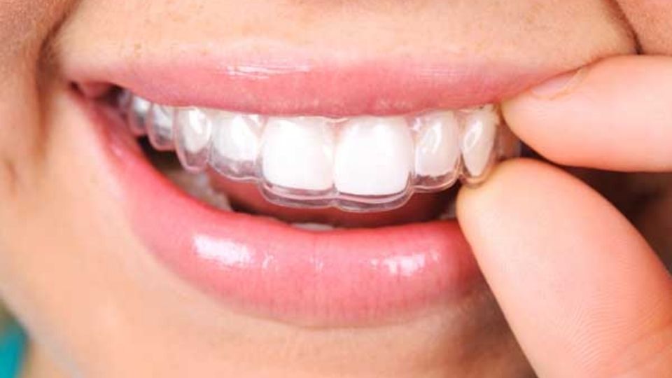 Dr VC Bhagwan Logo (1) Dr VC Bhagwan Family Dentistry Clear Aligners